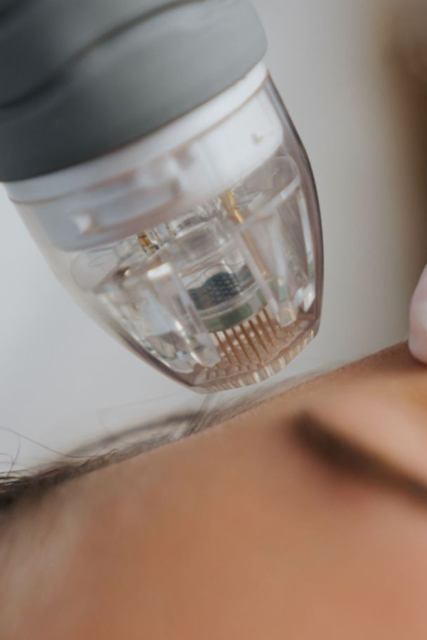 SYLFIRM X RF Microneedling Melbourne